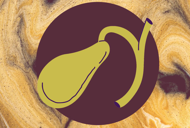 What happens to your gallbladder when you drink coffee every day