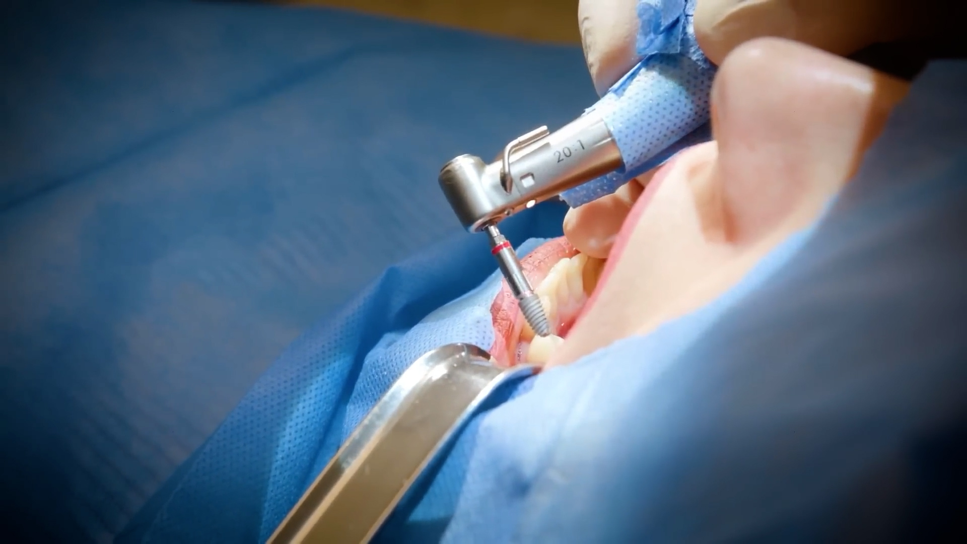 Tooth facts that patients rarely hear during a checkup