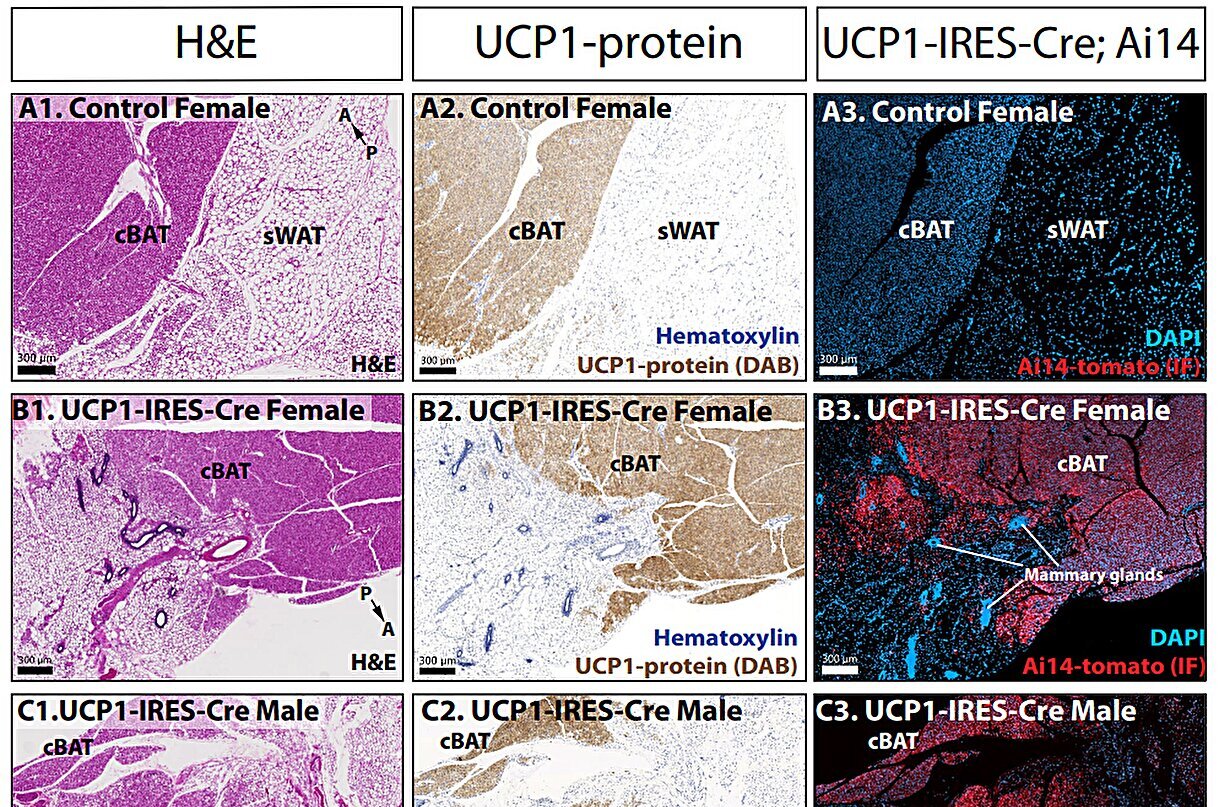New animal model offers more precise way to study calorie-burning brown fat