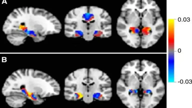 Una terapia no invasiva potencia el sistema de limpieza del cerebro y ...