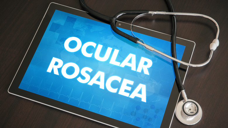 Everything you need to know about ocular rosacea
