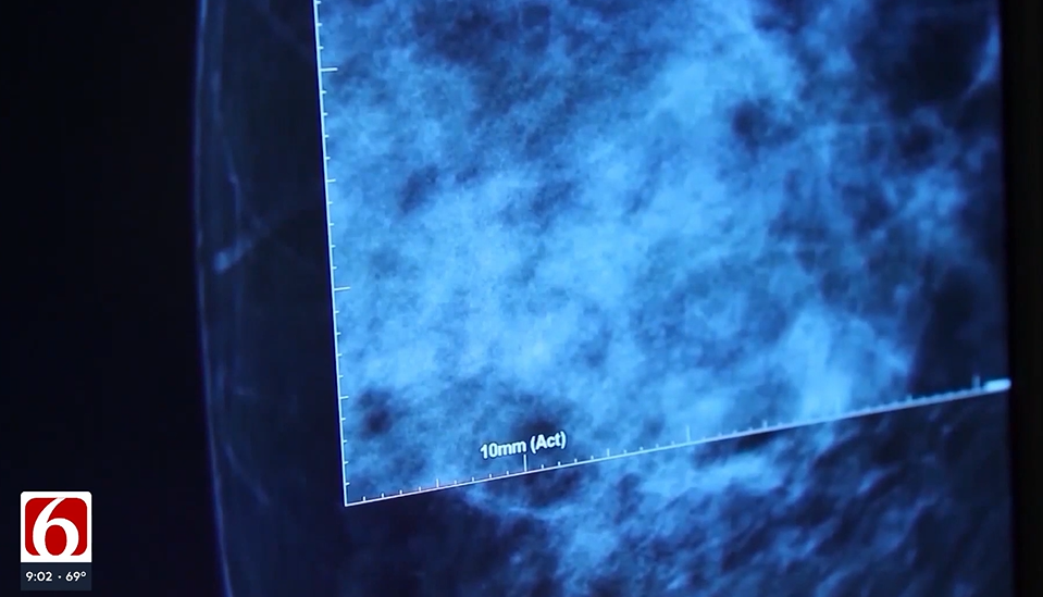 Male breast cancer: What symptoms should men look for, and why does ...