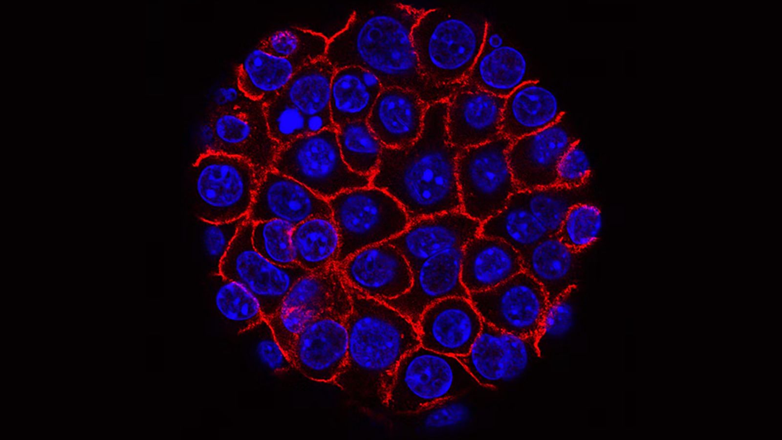 Japan's RIKEN scientists turn cancer cells' own gas against them to ...