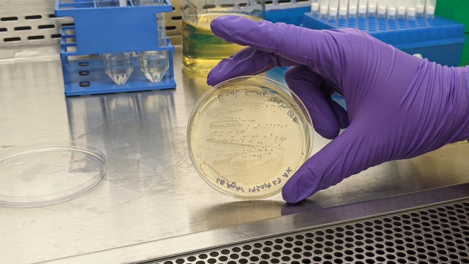 Could AI kill superbugs? Company says AI-designed phages given to first ...