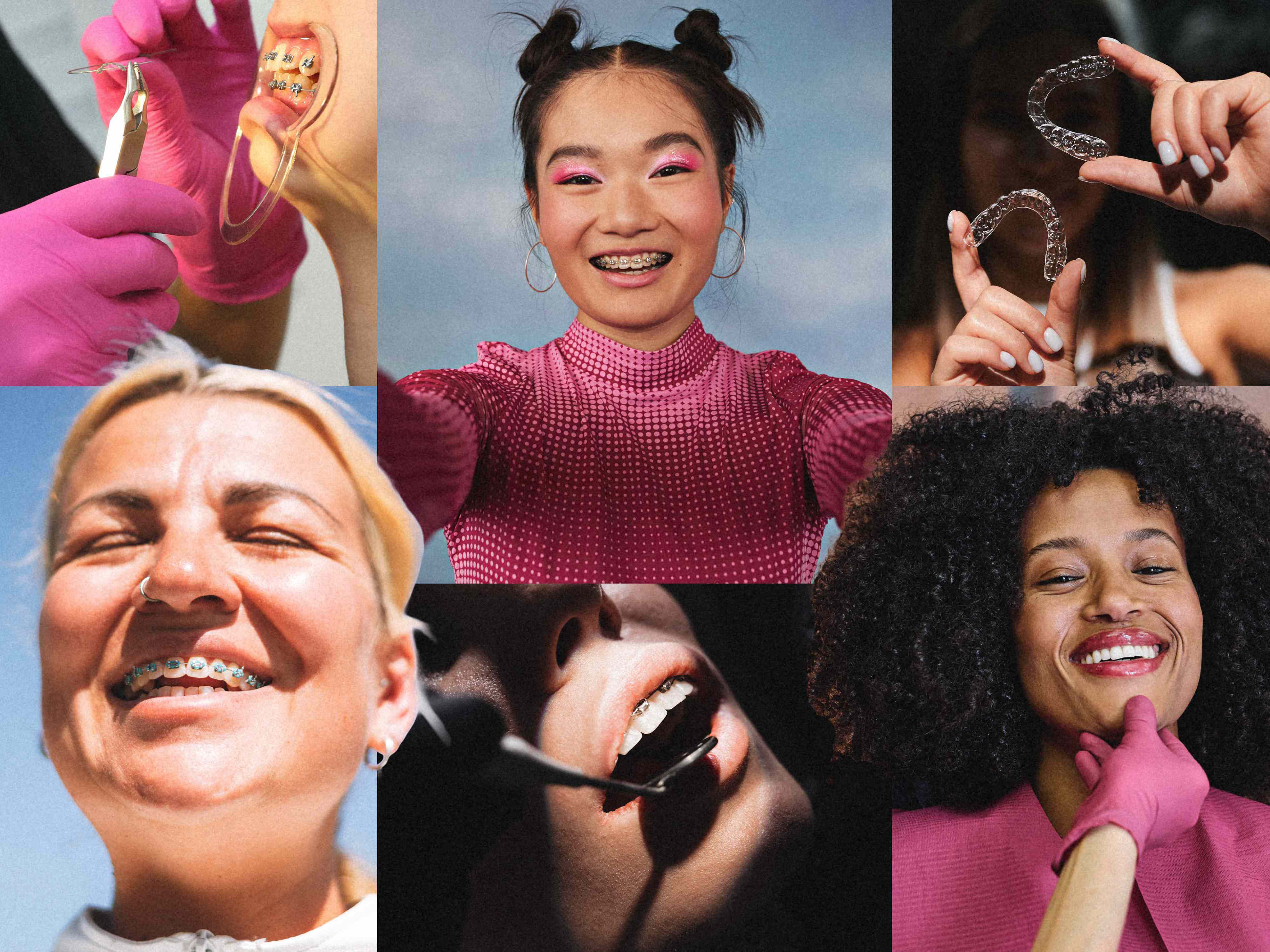 Straightening my teeth changed my face: The role of orthodontics in ...