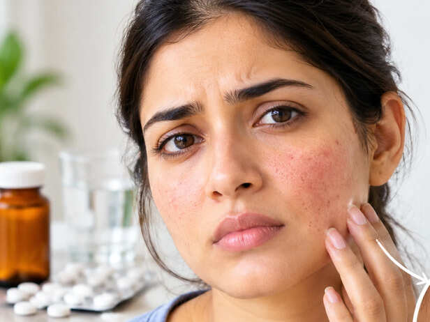Why do steroids change your skin, especially on your face?