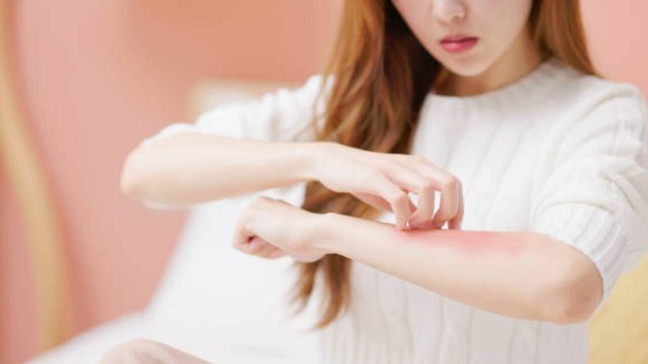 Dry winter skin? 5 gentle remedies that may help and 3 popular fixes to ...