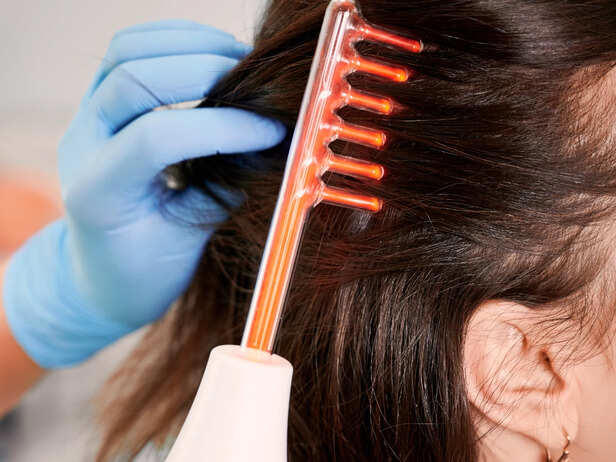 Scalp conditions that need a dermatologist, not a new shampoo