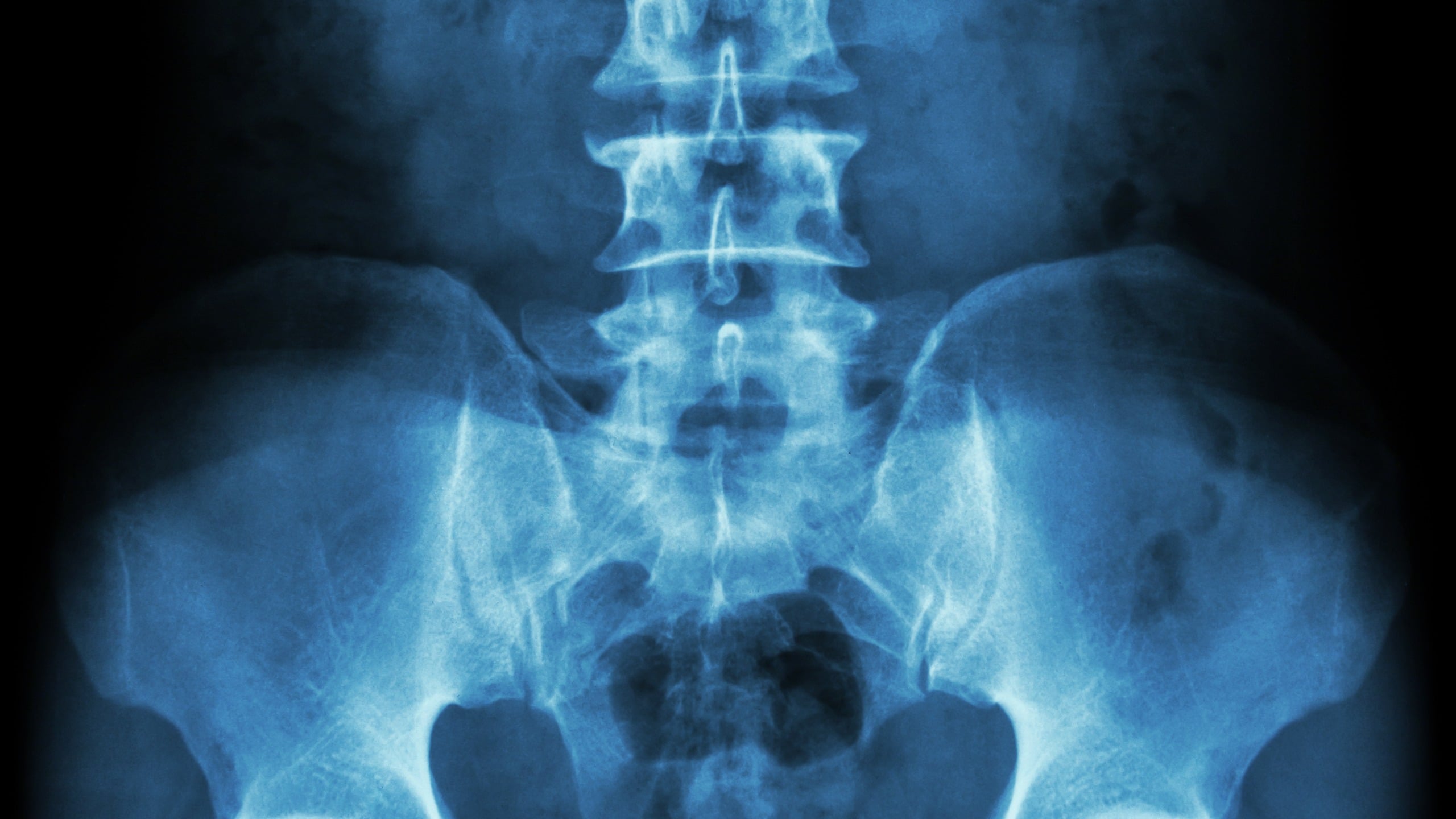 Testosterone may have an unexpected benefit for women's bones after ...