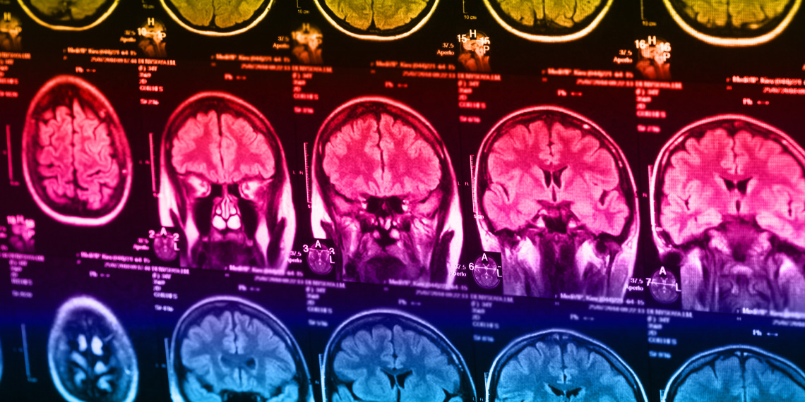 Challenges to political beliefs might engage brain networks tied to ...