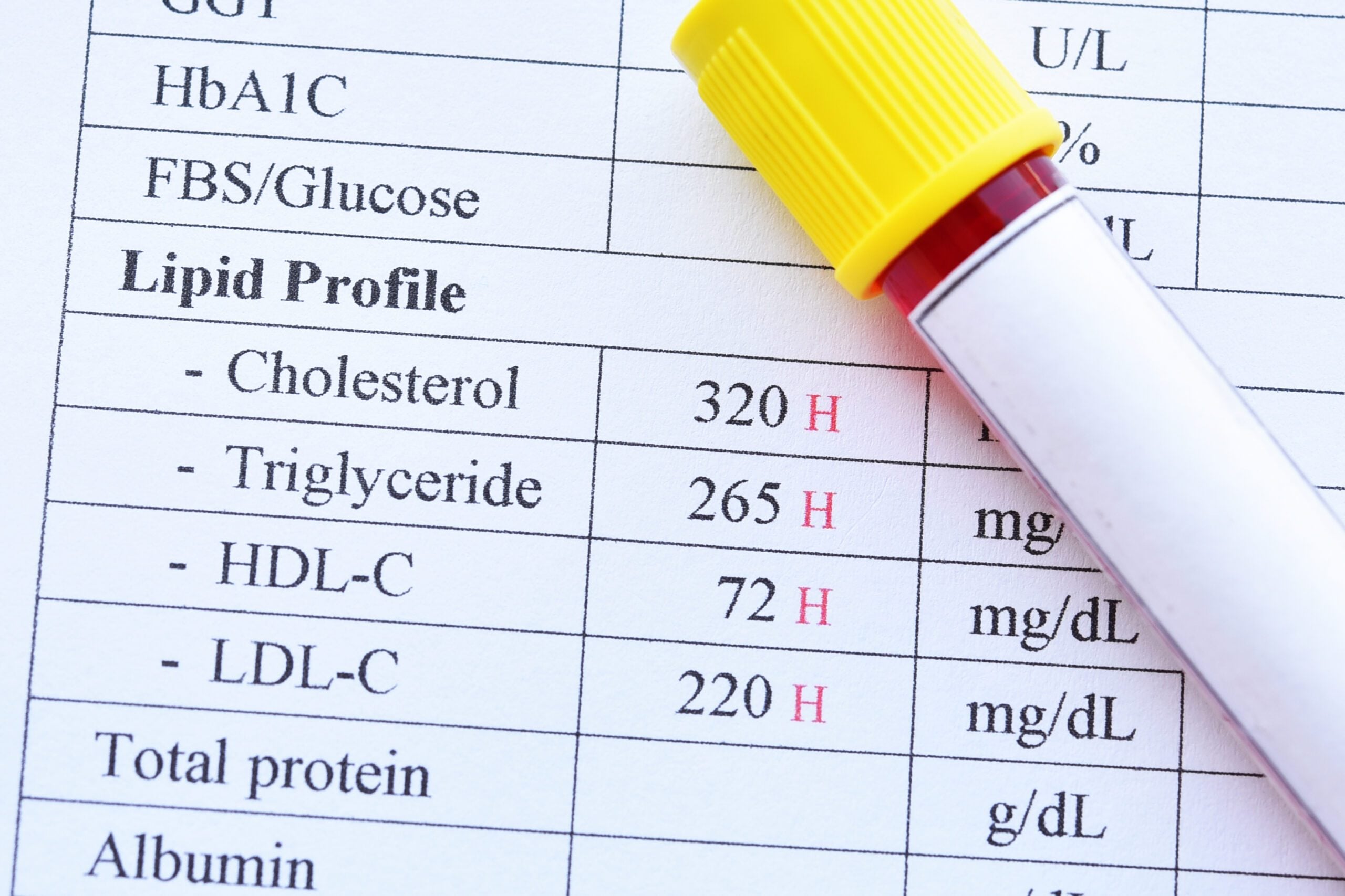 4 important things you probably don’t know about triglycerides ...