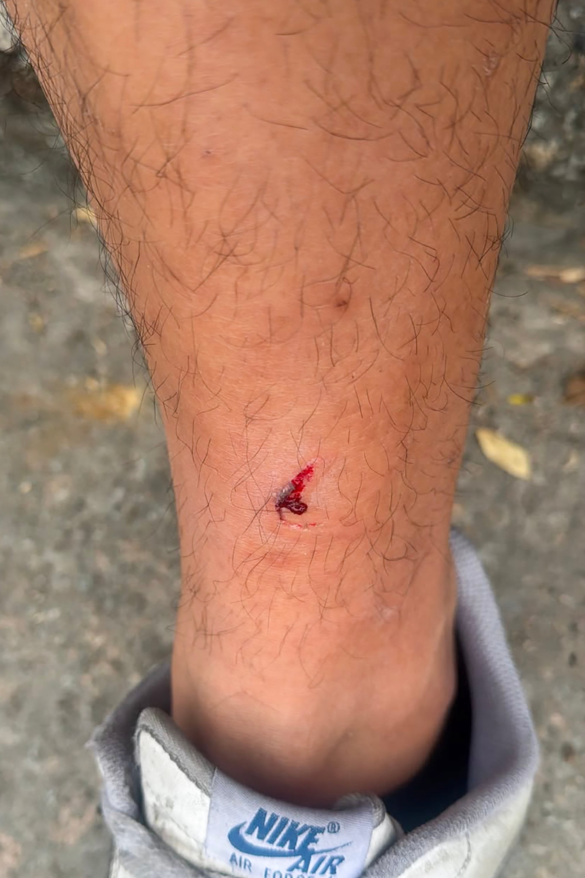 Man bitten after being chased by 3 dogs on his way to work in Yuen Long