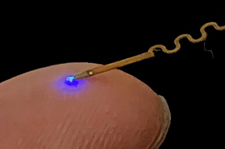 Wireless neural chip tracks brain changes in real time after Alzheimer ...