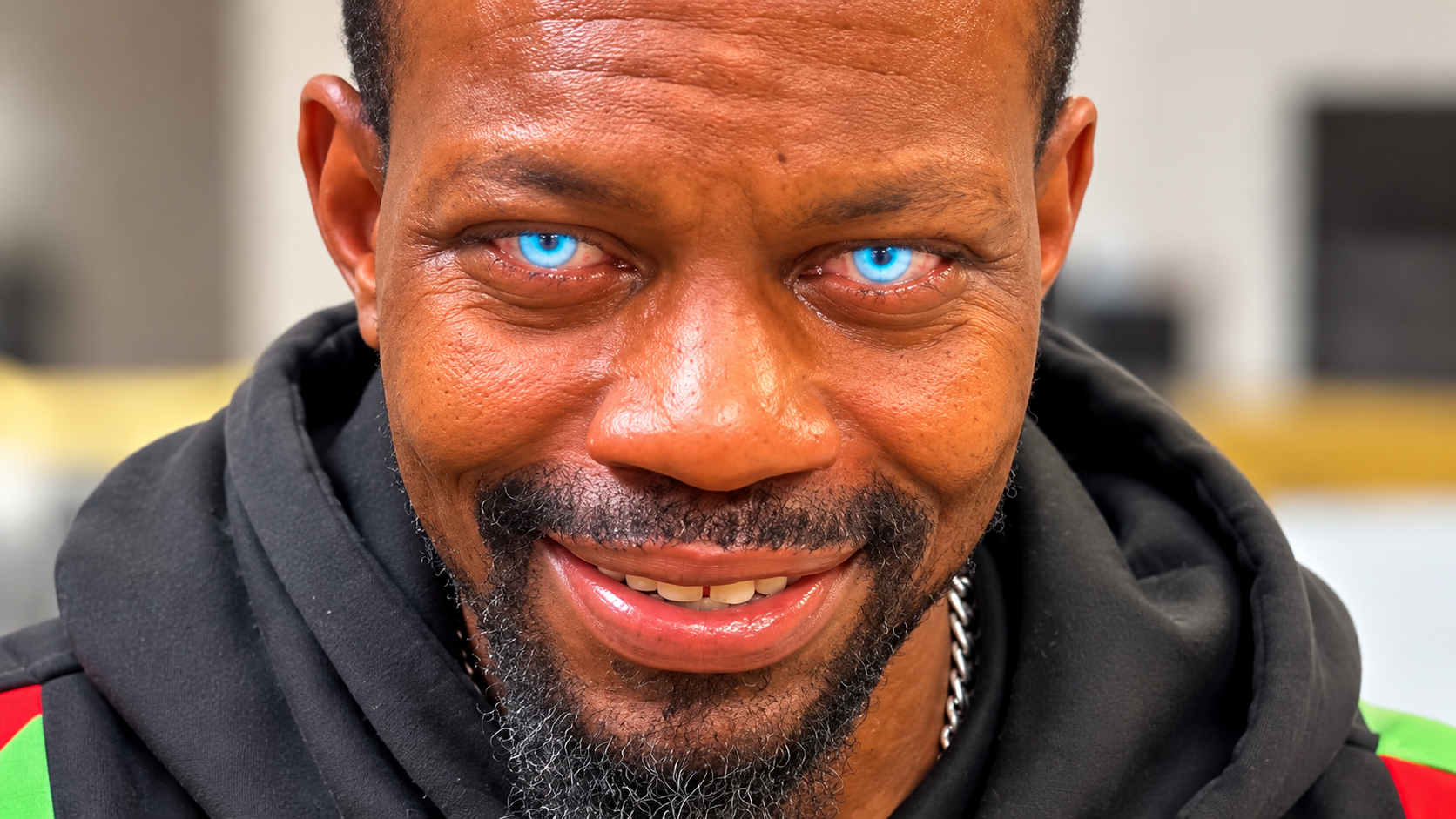 Why viral eye color surgery raises safety concerns