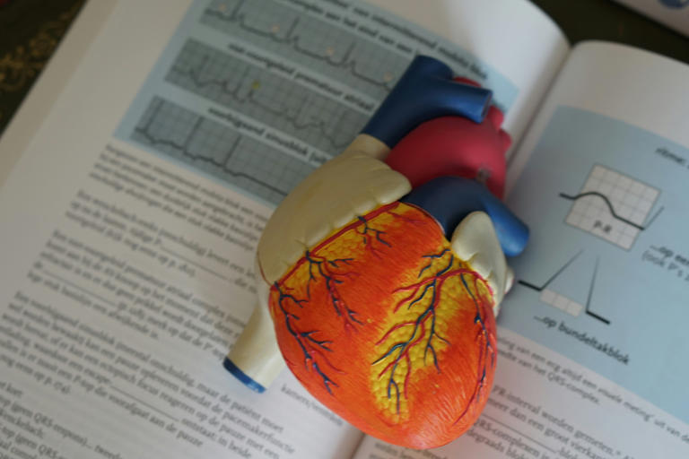Four societies publish first unified women's cardiovascular health ...