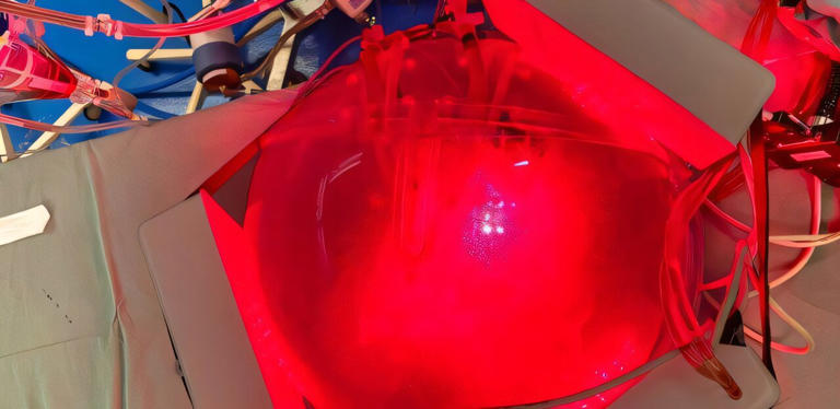 Chest 'digital twin' predicts light paths to help plan personalized ...