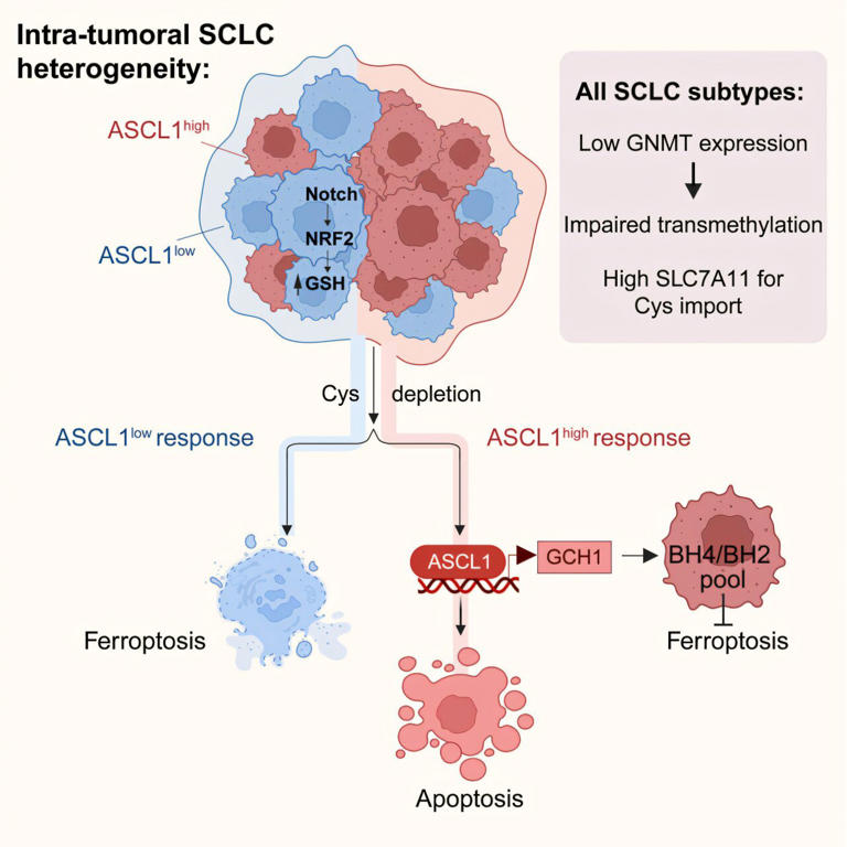 Metabolic vulnerability identified in small cell lung cancer