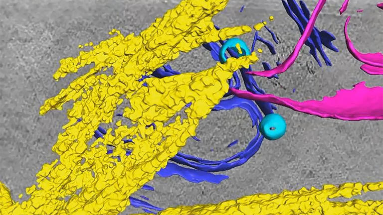 Protein fibers, a hallmark of Alzheimer's, spotted making genetic ...