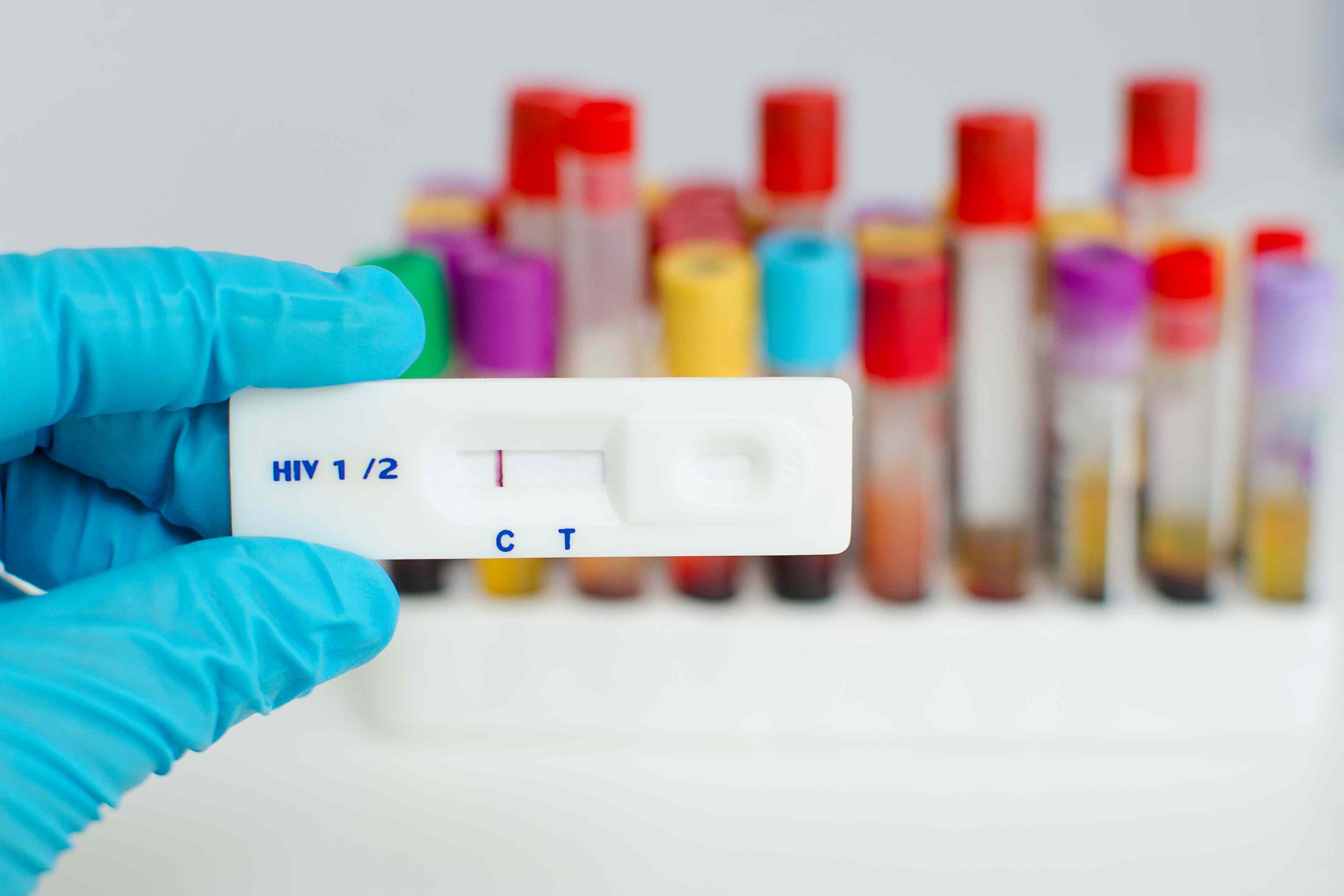 How often do you actually need an HIV test?