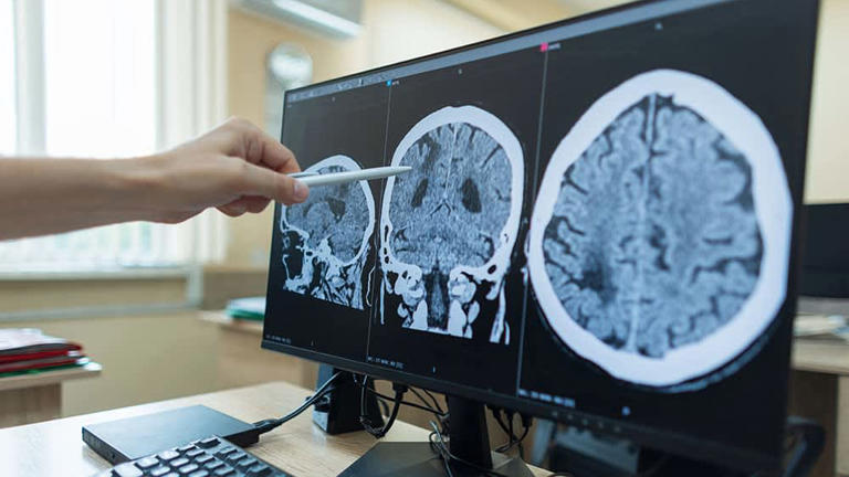 Xencor catapults on 'unprecedented,' 'profound' cancer data