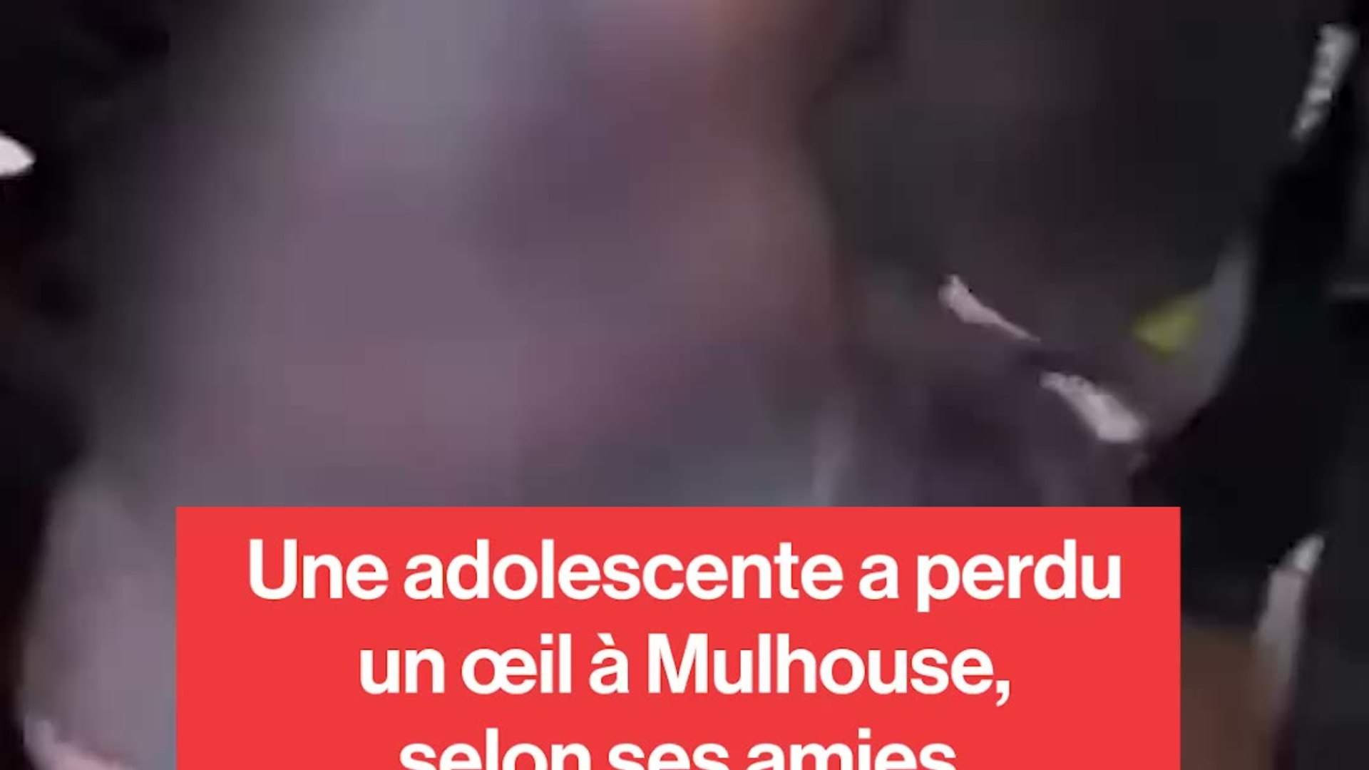 Une adolescente a perdu un œil à Mulhouse le 17 octobre, l'IGPN a été ...
