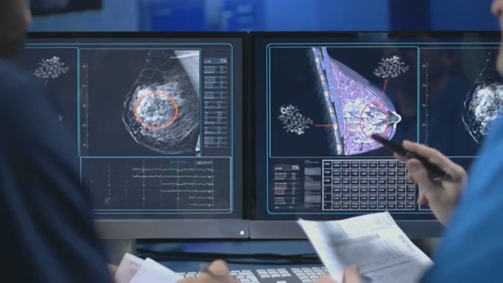 Breast density's role in cancer detection: 'Know your risk. Know your ...