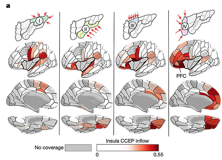 Detailed brain map reveals how the insula shapes bodily sensations and ...