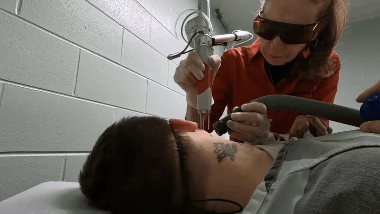 Local program helps people in jail remove tattoos and start fresh