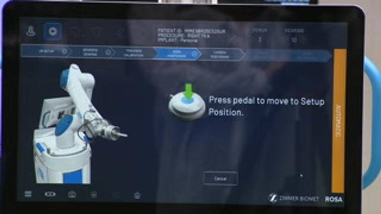 WVU Medicine Weirton Medical Center unveils new robotic-assisted knee ...