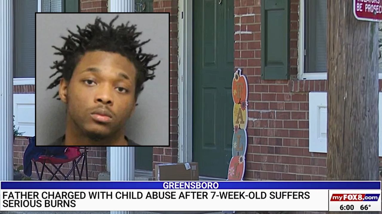 Dad dumps 7-week-old baby on grandparents with 3rd-degree burns from ...