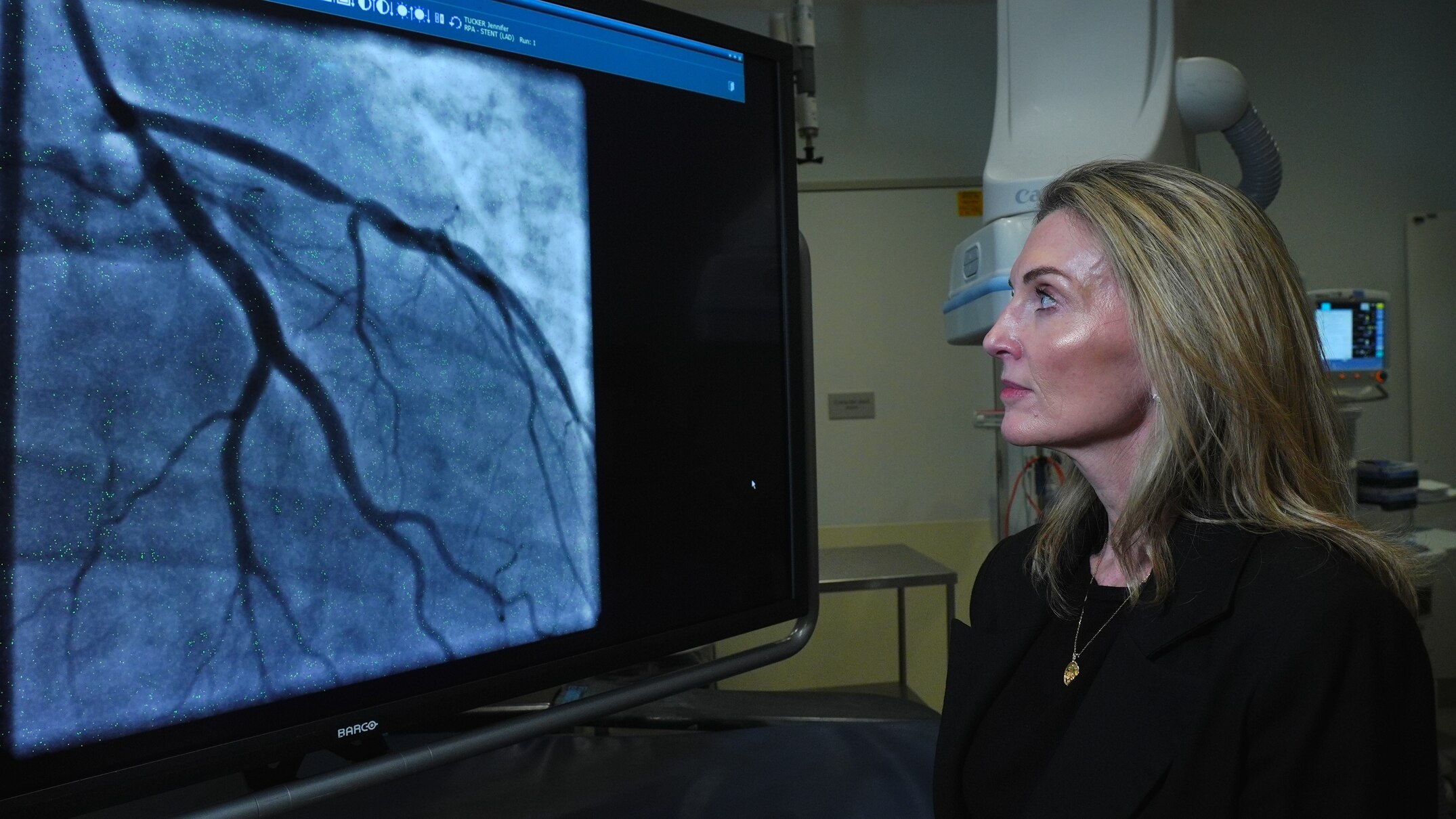 Sydney researchers claim breakthrough in fight to end silent heart disease