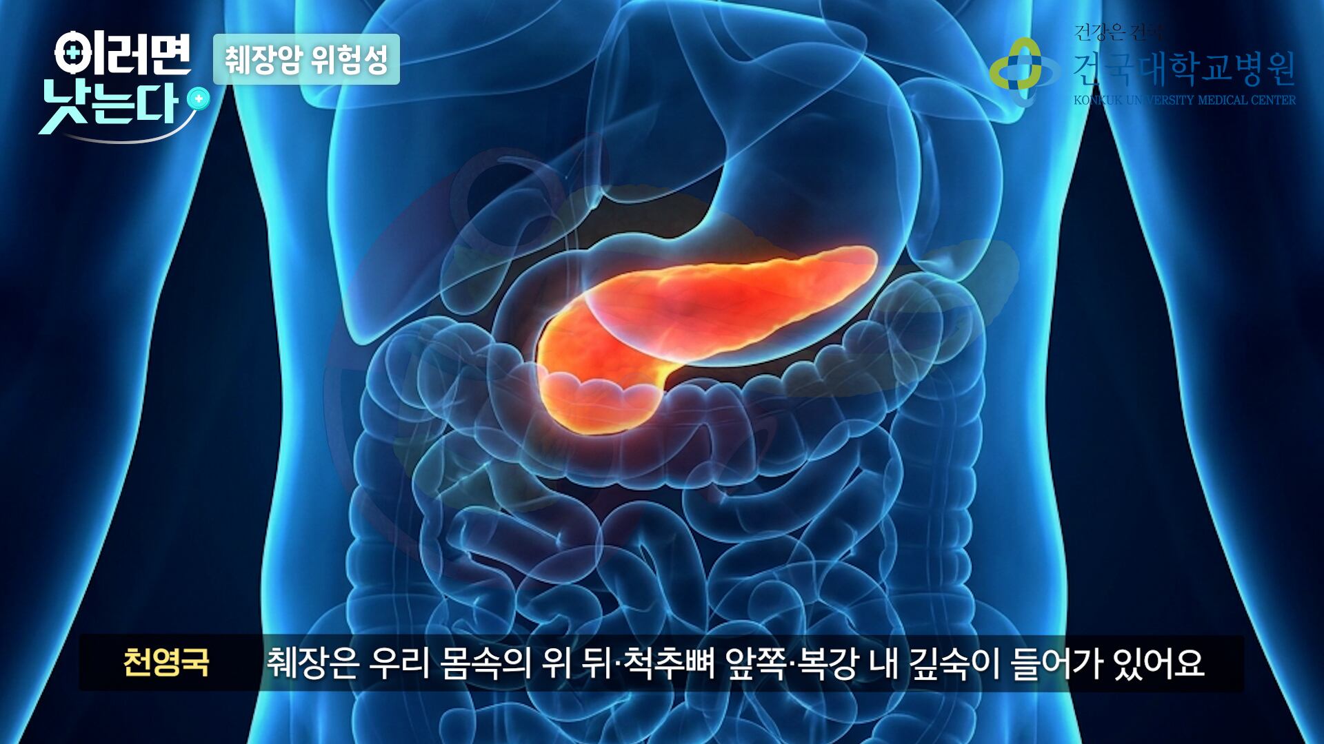 Pancreatic cancer: Five easy-to-miss symptoms identified