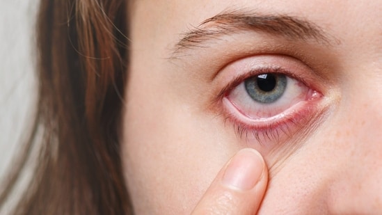 Doctor shares warning signs of vision loss you may be ignoring: From ...