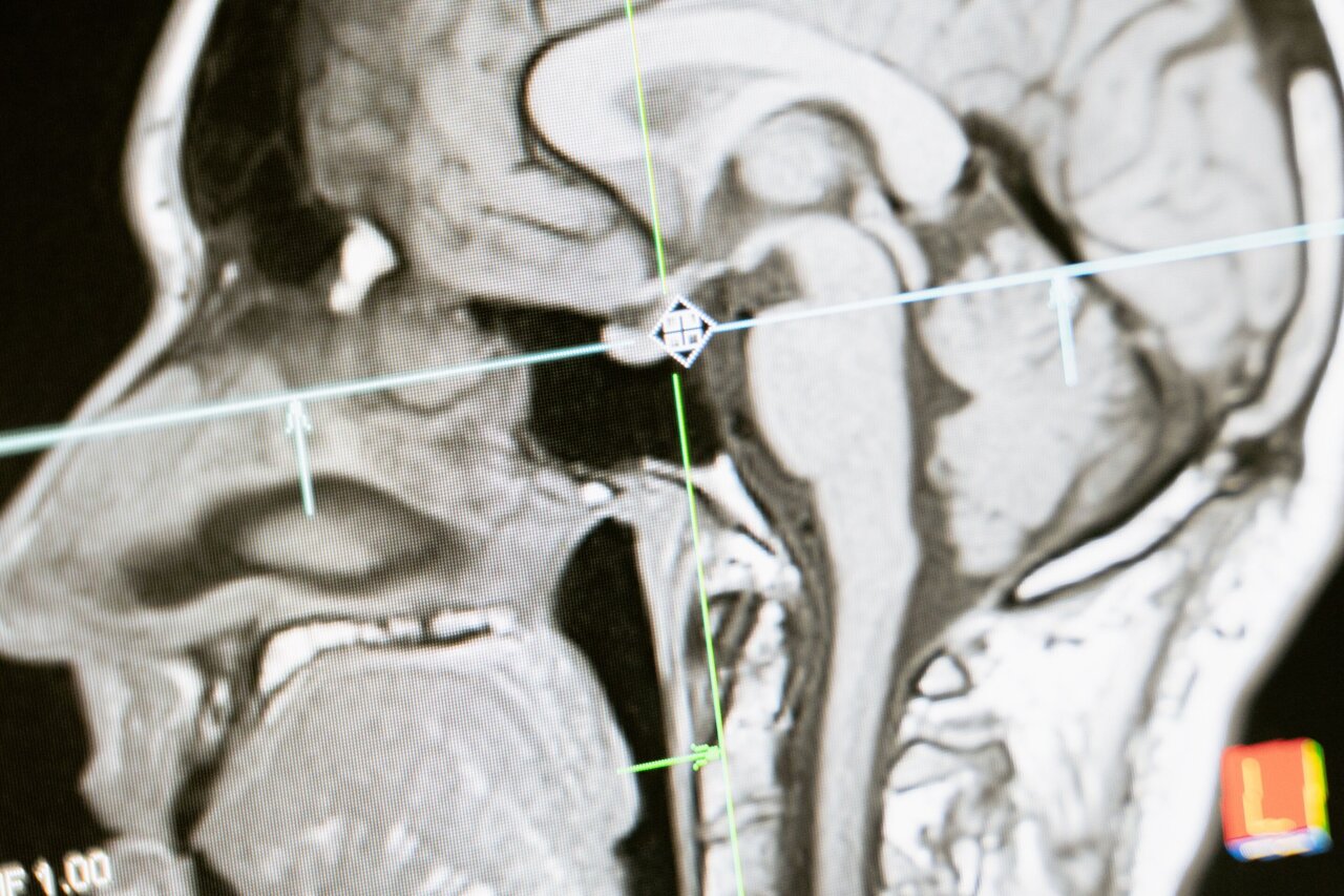 Amygdala activity predicts which new images may become lasting memories