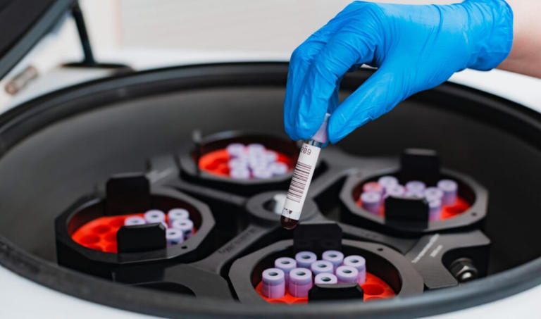 Beyond the spin: Can Indian centrifuge makers move up the technology curve?