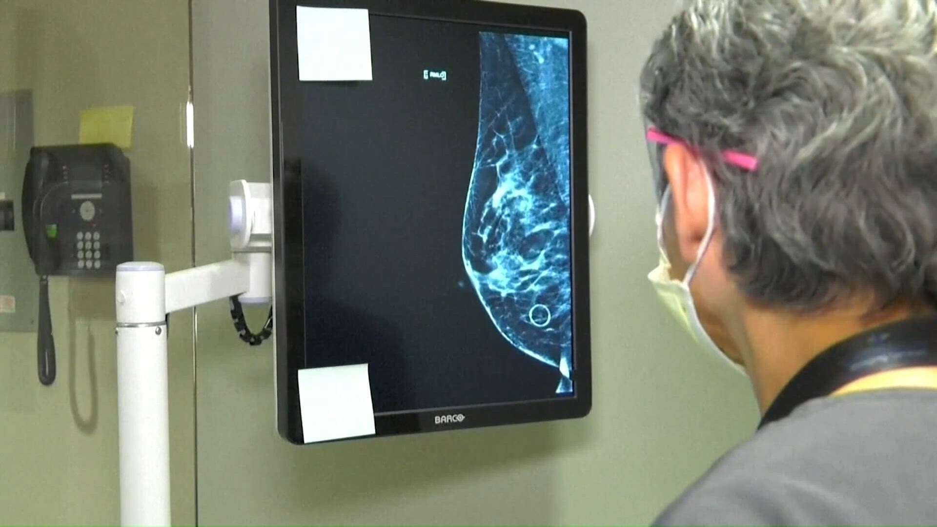 Minority women are more prone to aggressive breast cancer: Why early ...