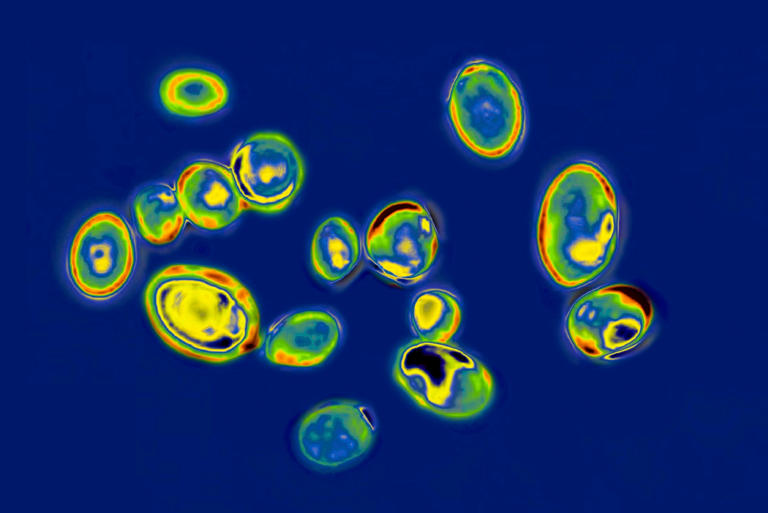 Drug-resistant germs are 'growing threat' to US, causing 50,000 deaths ...