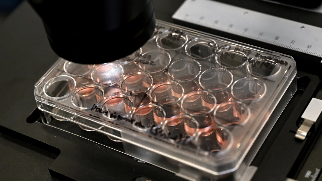 German scientists reverse 60 years of aging in human cells