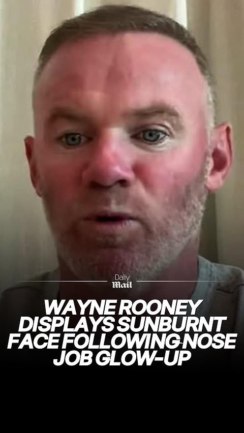 Wayne Rooney displays a sunburnt face following weight loss