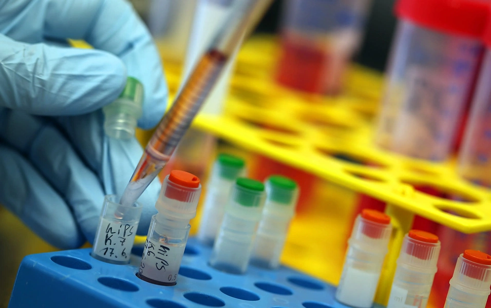 German scientists reverse 60 years of aging in human cells
