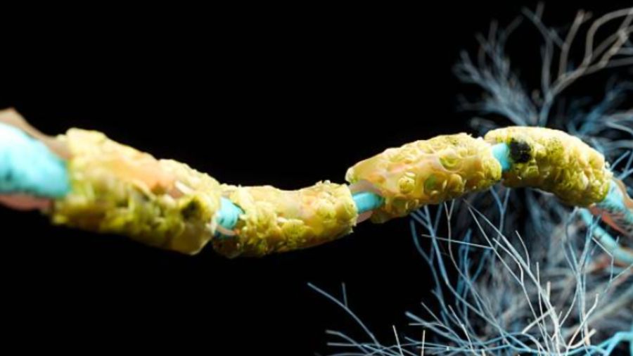 Global teal campaign brings Alzheimer’s awareness to iconic Hawaiʻi ...