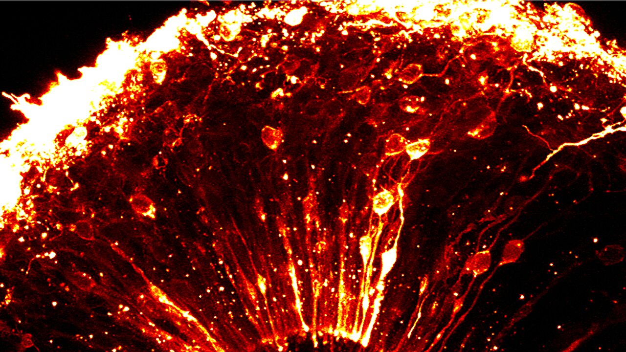 What makes us human? Researchers compare brain development in humans ...
