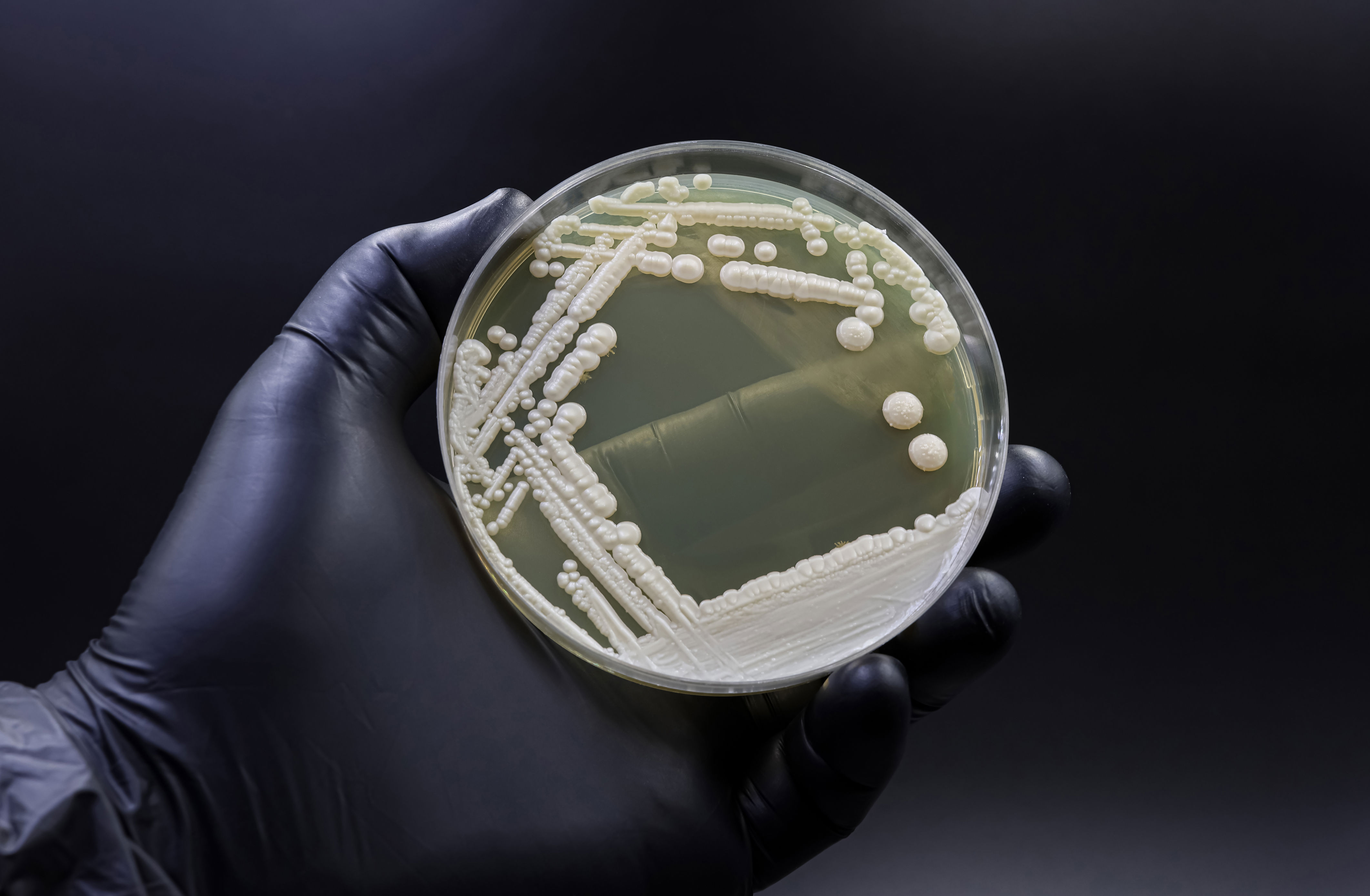 Why dangerous fungi are on the rise