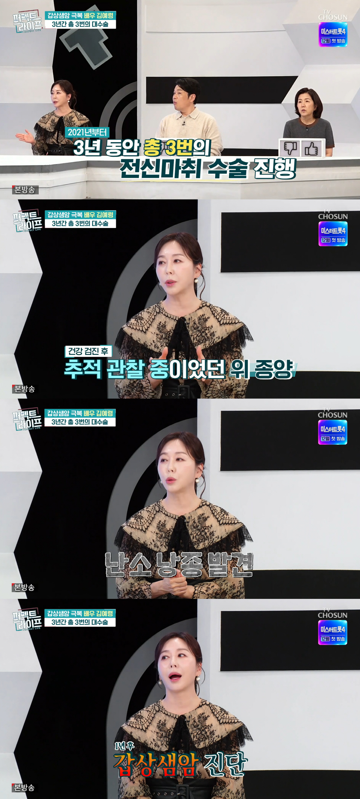 60-year-old Kim Ye-ryeong after cancer surgery poses for sweet couple ...