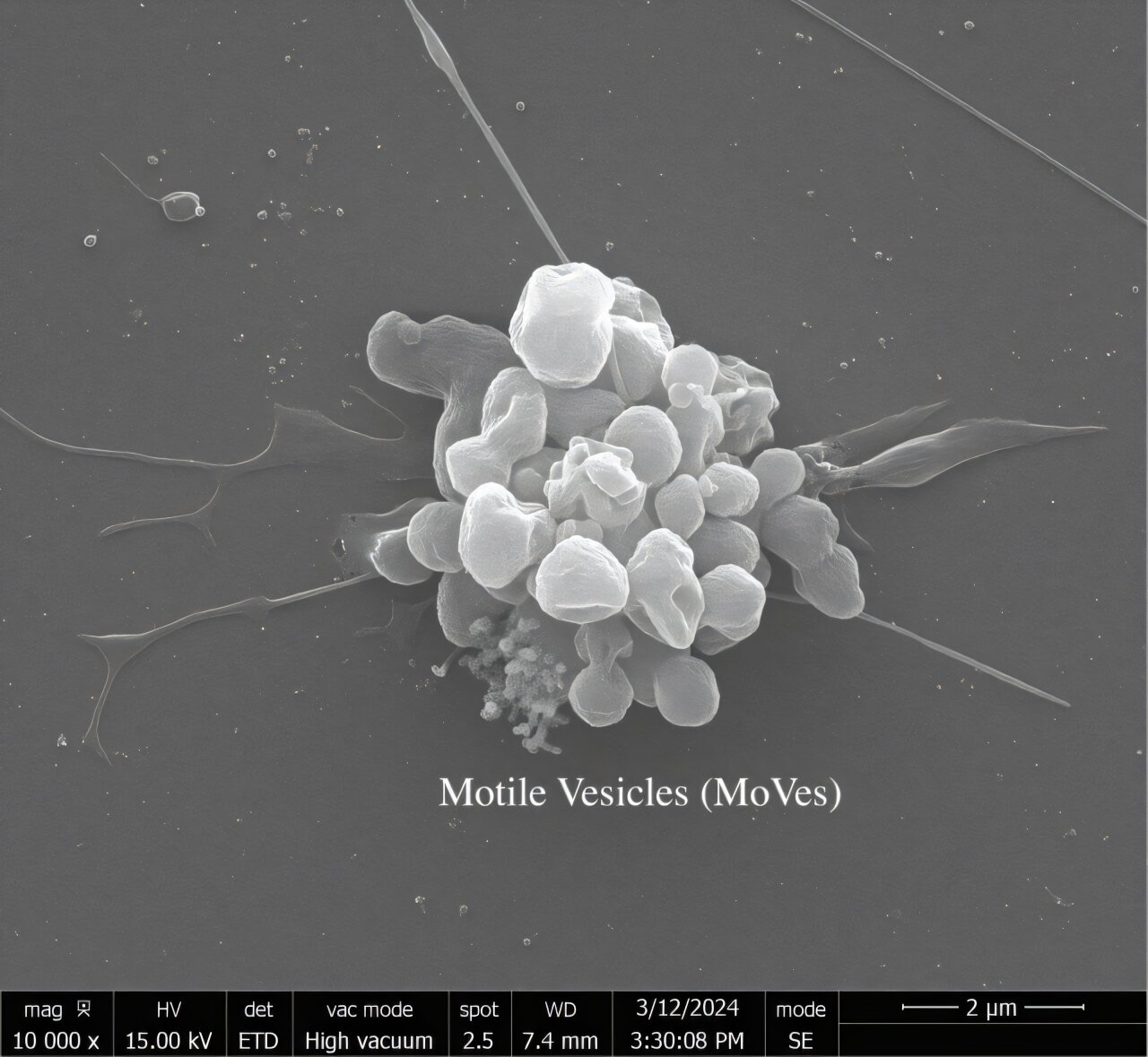 Extracellular vesicle discovery may shed light on how cancer spreads