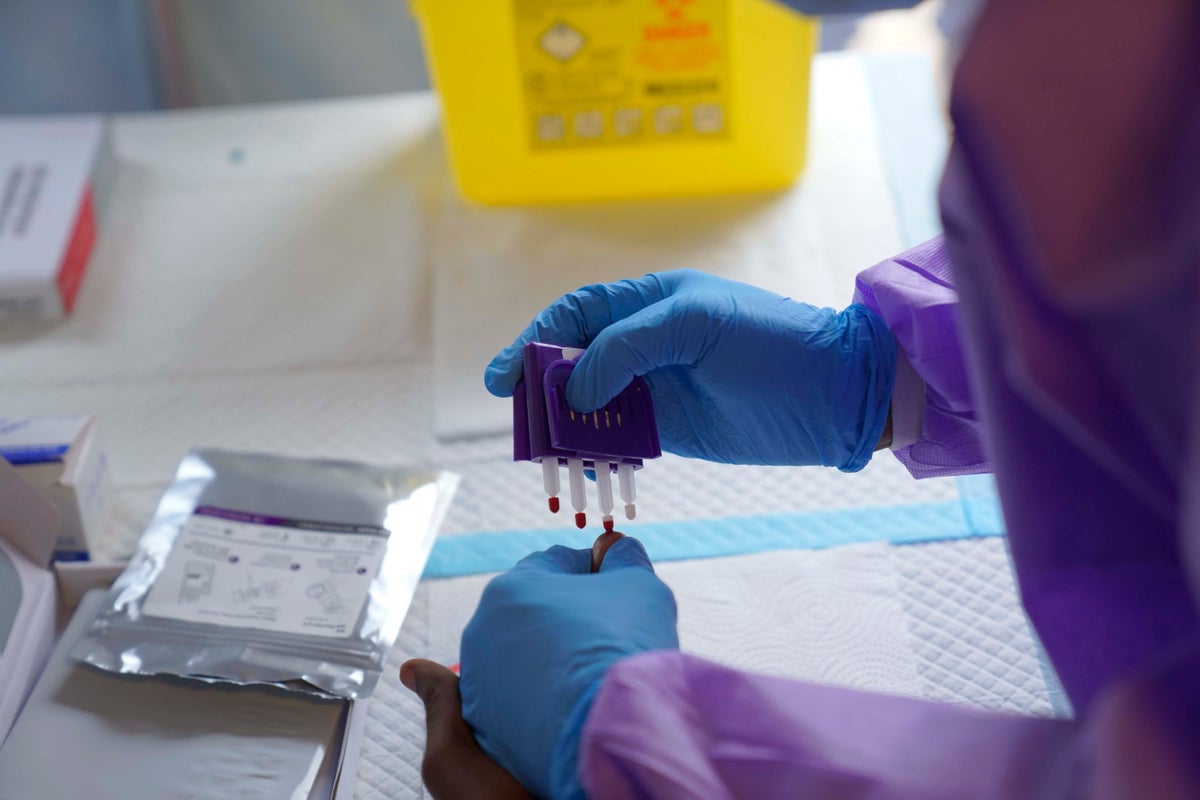 Top health expert warns Ebola could spread globally like Covid
