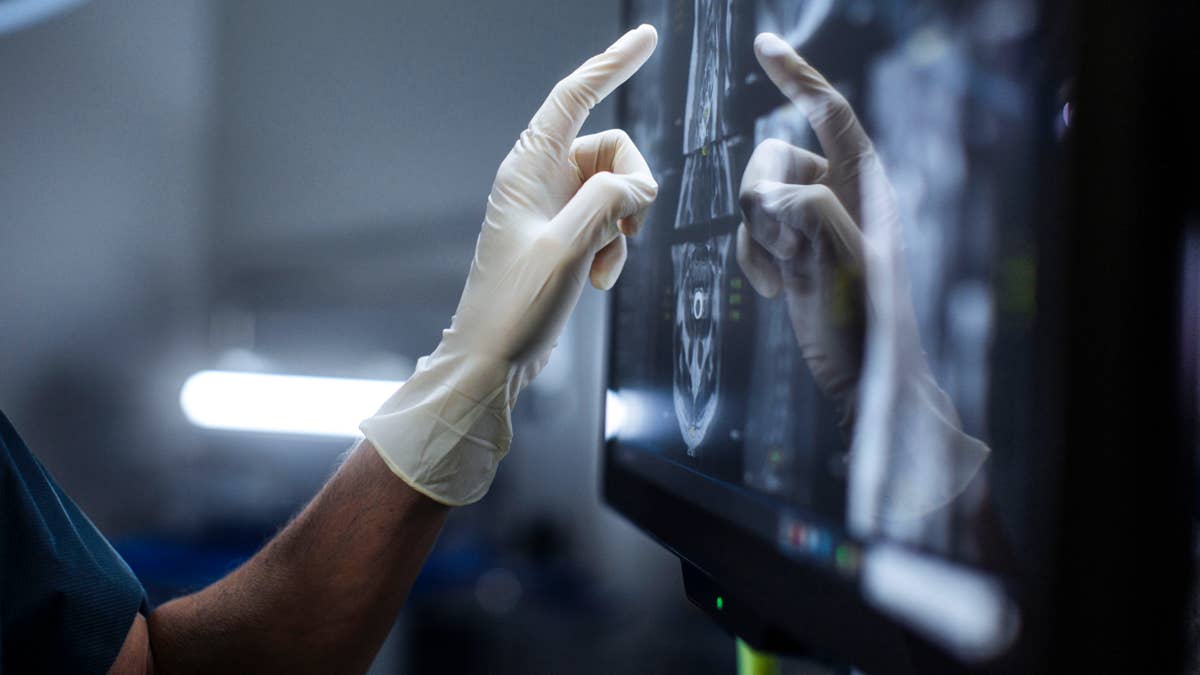 Routine CT scans may detect signs of pancreatic cancer years before ...