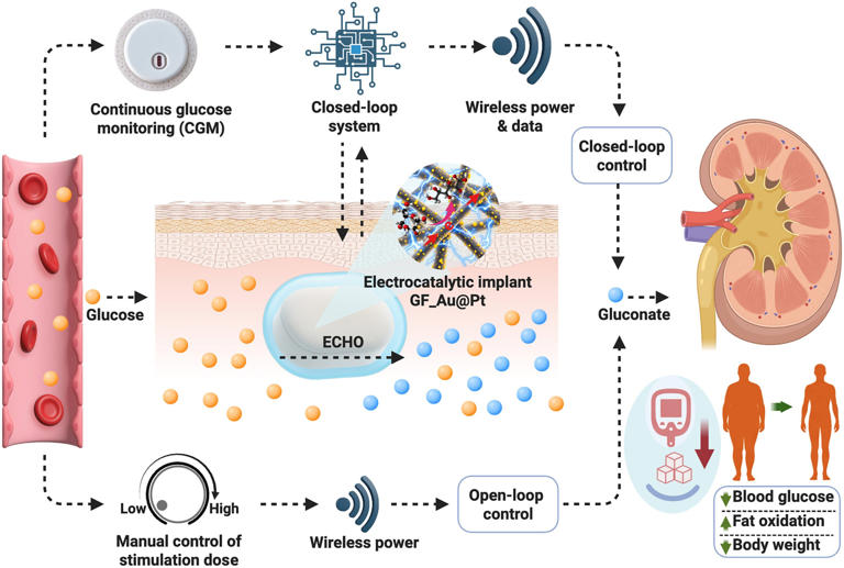 ETH Zurich’s electronic implant lowers blood sugar and body weight