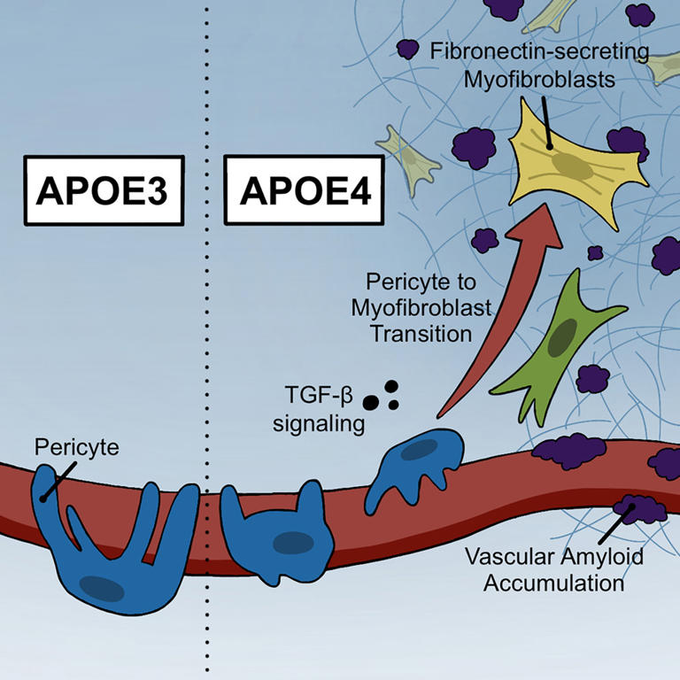 Alzheimer’s best-known risk gene turns brain vessel cells into scar ...