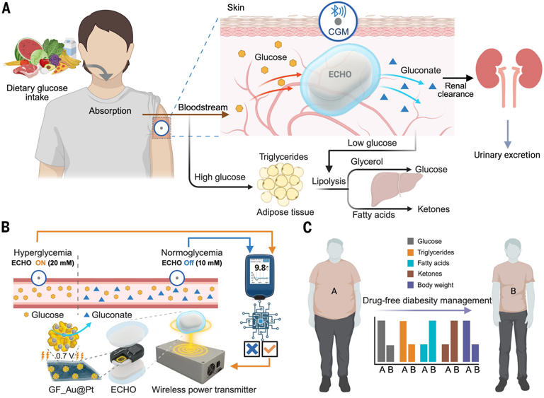 ETH Zurich’s electronic implant lowers blood sugar and body weight